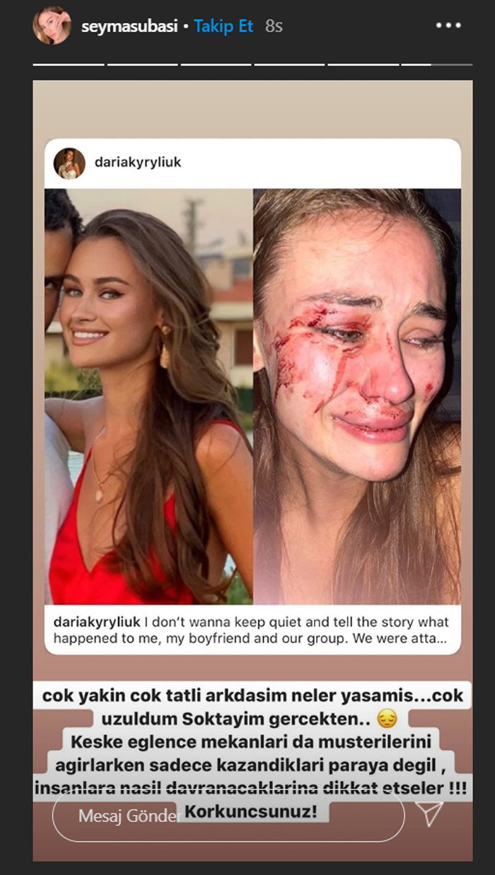 Momo Beach’te özel güvenlikçilerin saldırdığı model Daria Kyryliuk kimdir? - Resim: 4