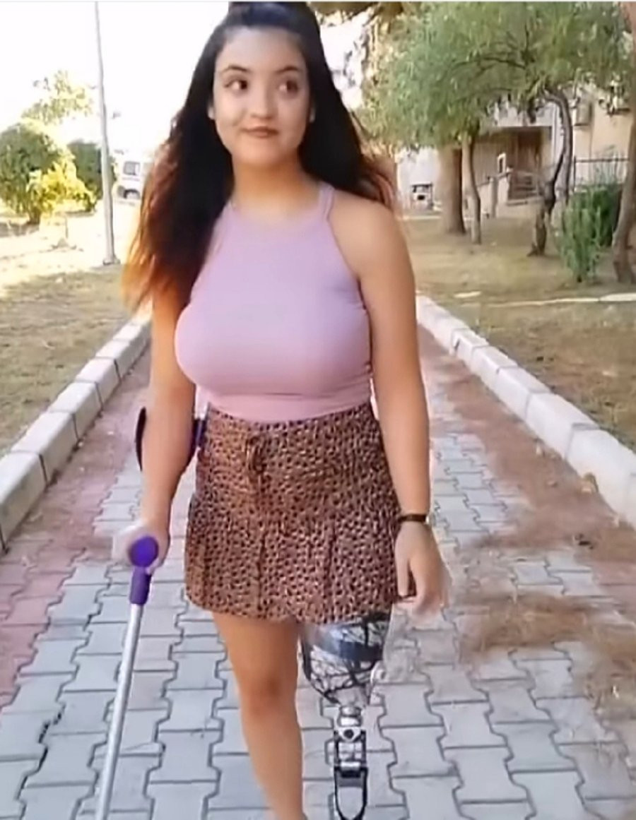 Protez Bacağıyla Video Paylaşan Kadına Gelen İğrenç Yorumlar Pes dedirtti - Resim: 2