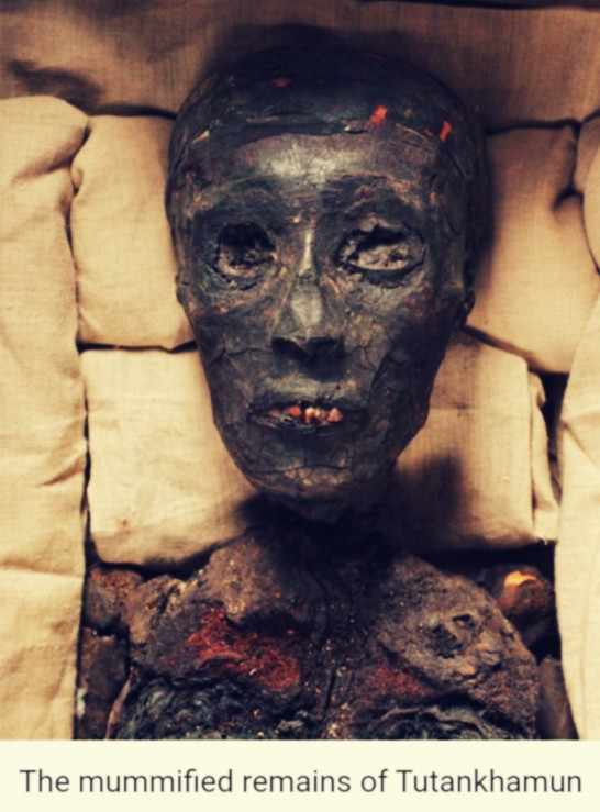 Kral Tutankhamun'un Laneti mi? İngiliz Lordların Esrarengiz Ölümleri - Resim: 4