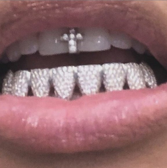 Kim Kardashian'ın 5 bin Dolarlık Diş Mücevheri - Resim: 2
