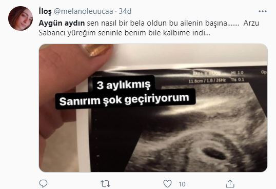 Aygün Aydın'dan Şok Hamilelik Paylaşımı! Sosyal Medya Sallandı - Resim: 6