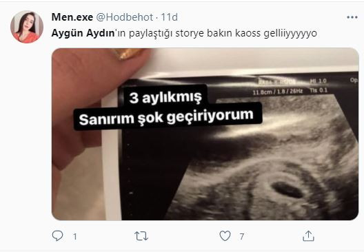 Aygün Aydın'dan Şok Hamilelik Paylaşımı! Sosyal Medya Sallandı - Resim: 7