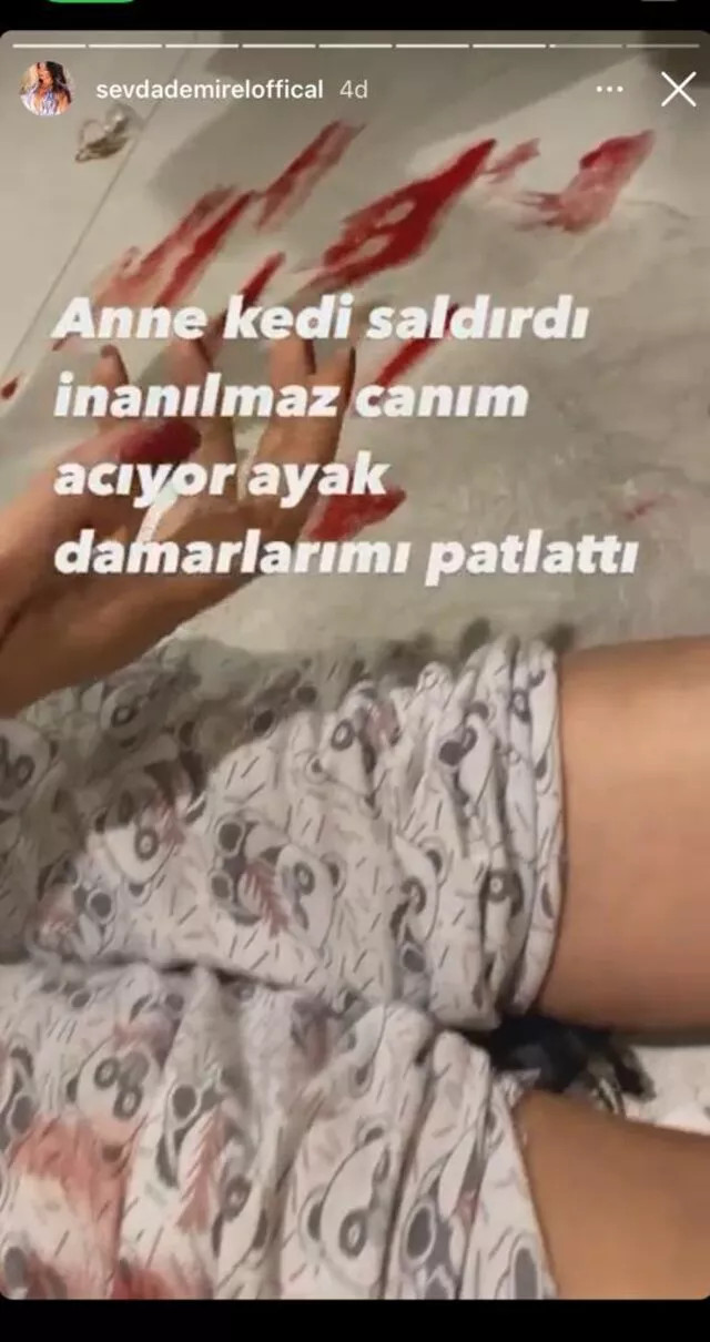 Sevda Demirel'e Kedi Saldırdı: Ayak Damarlarımı Patlattı - Resim: 2